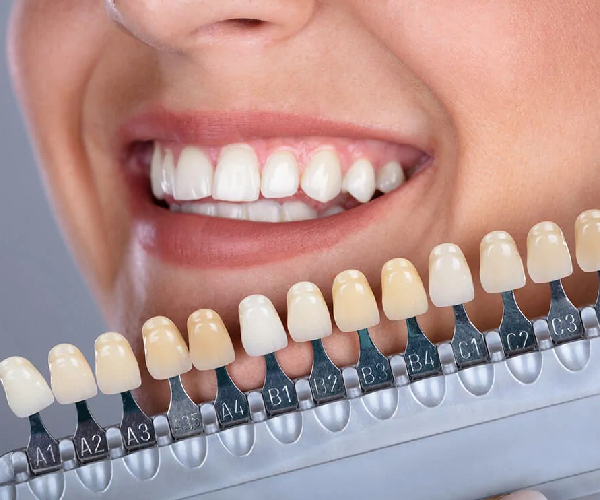 Cosmetic Dentistry