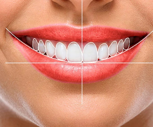 Express Smile Design