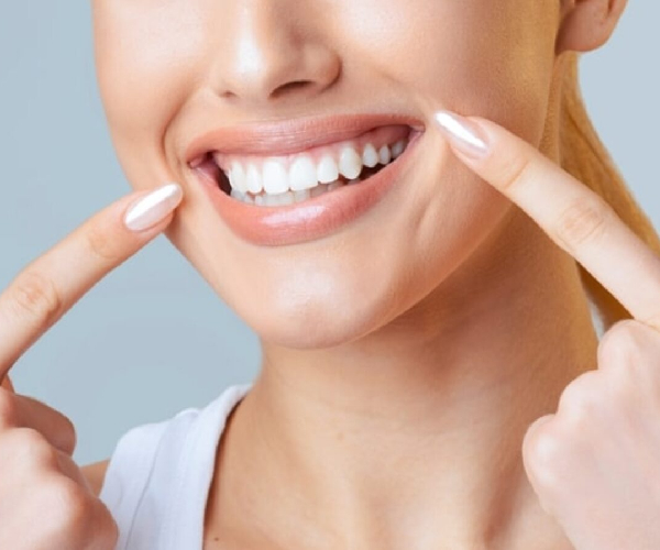 Smile Makeover