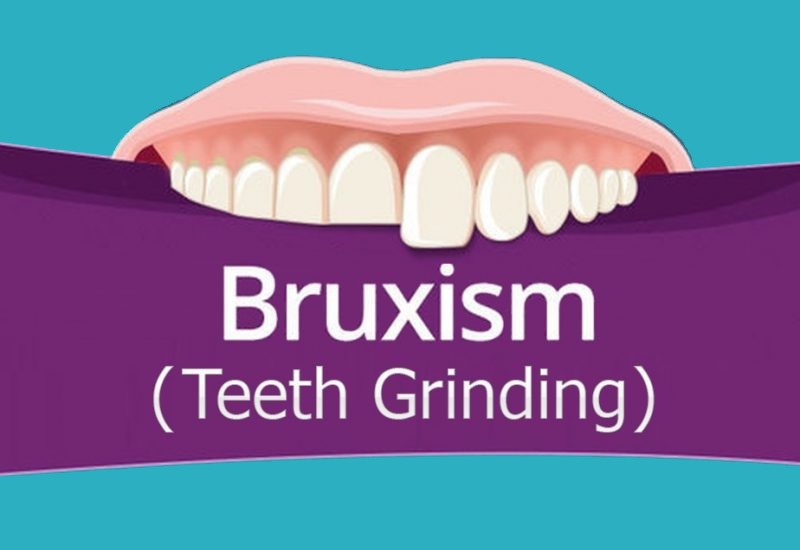 Bruxism: Are You Hurting Your Teeth While You Sleep?