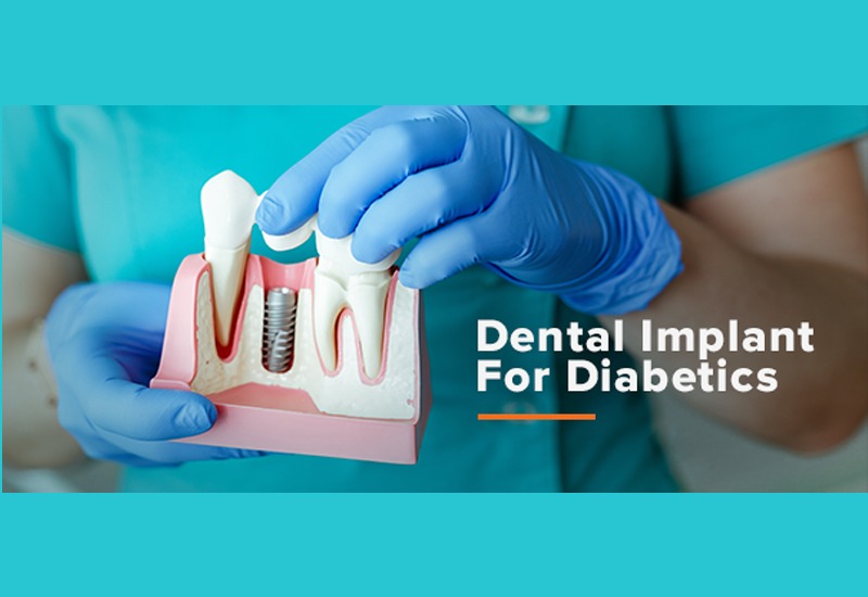 Is dental implant safe for diabetic patients?