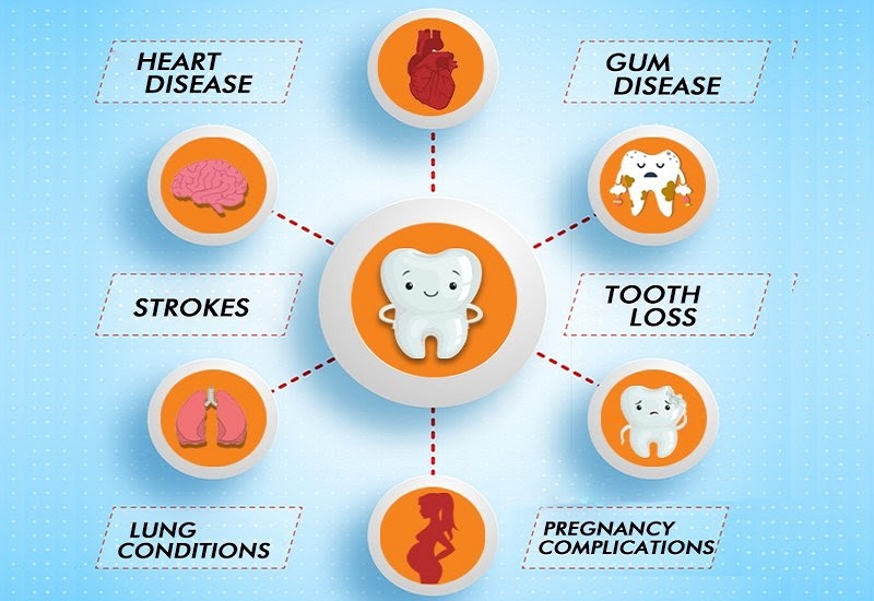 Stroke and Oral Health: Is There A Connection?