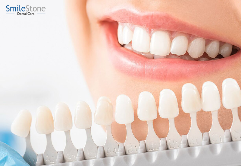 What Does Cosmetic Dentistry Require?