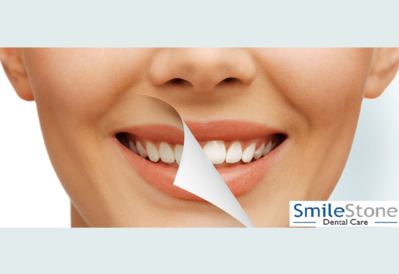 How can a Cosmetic Dentist help you achieve a good Smile?