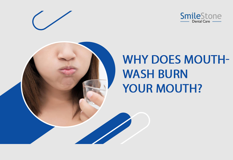 Why does Mouthwash burn? How can we take care of it?