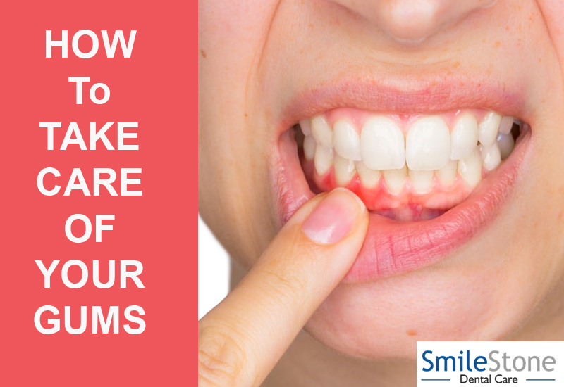 How to Take Care of your Gums