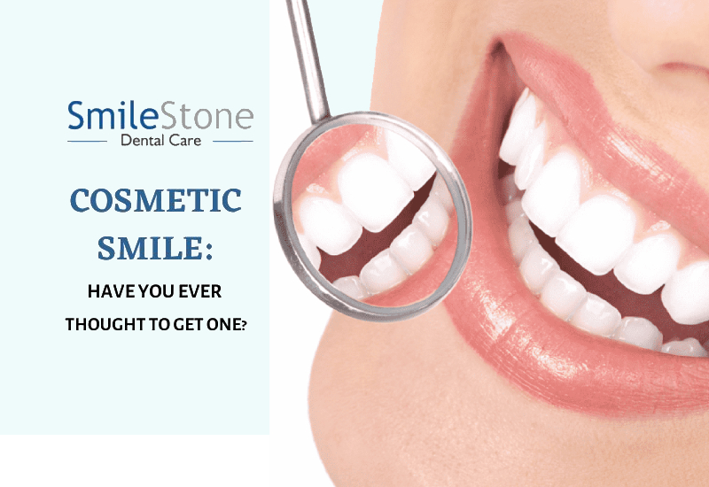 Cosmetic Smile: Have You Ever Thought to Get One?