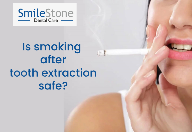 Is smoking after tooth extraction safe?