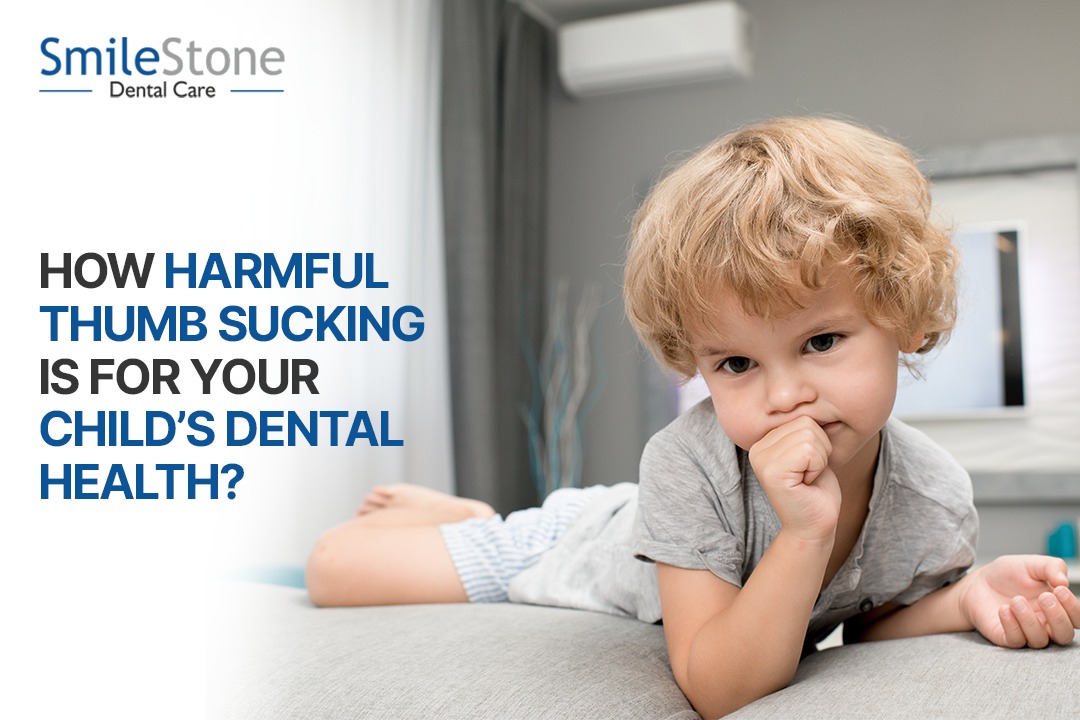 How Harmful Thumb Sucking is for Your Child’s Dental Health?