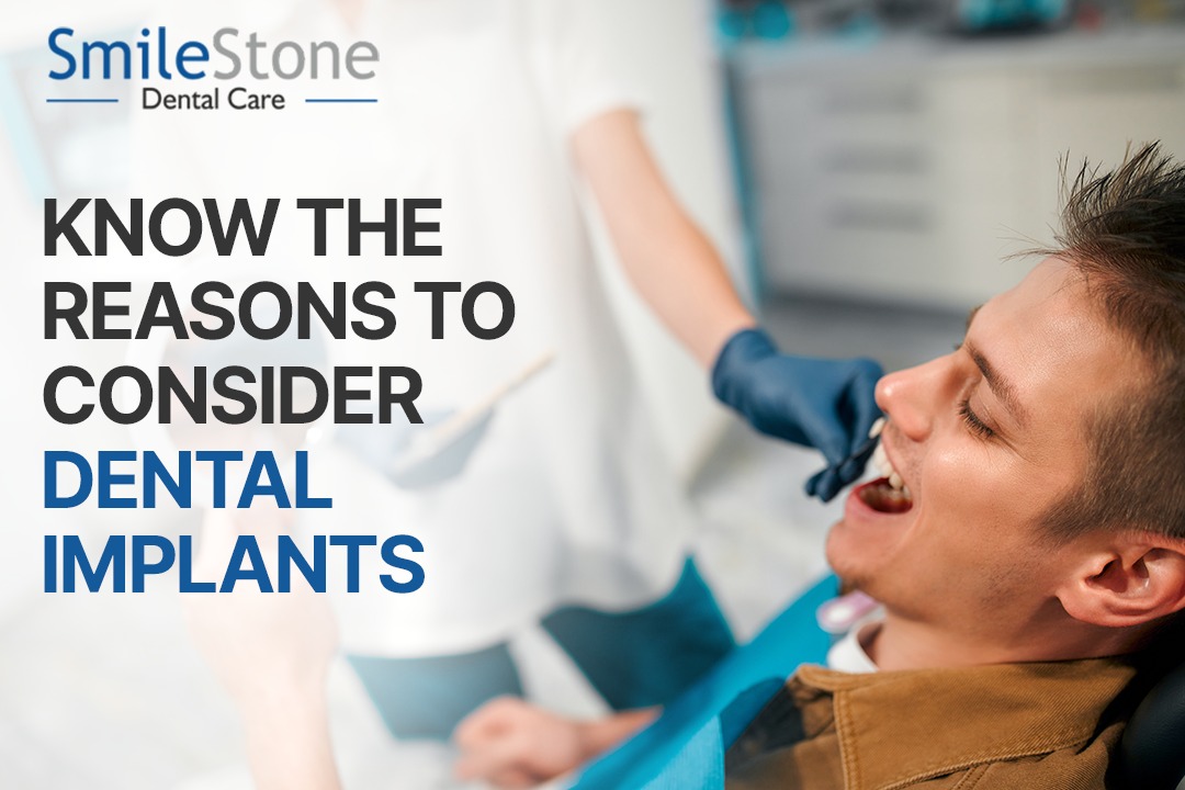 Know the Reasons to Consider Dental Implants