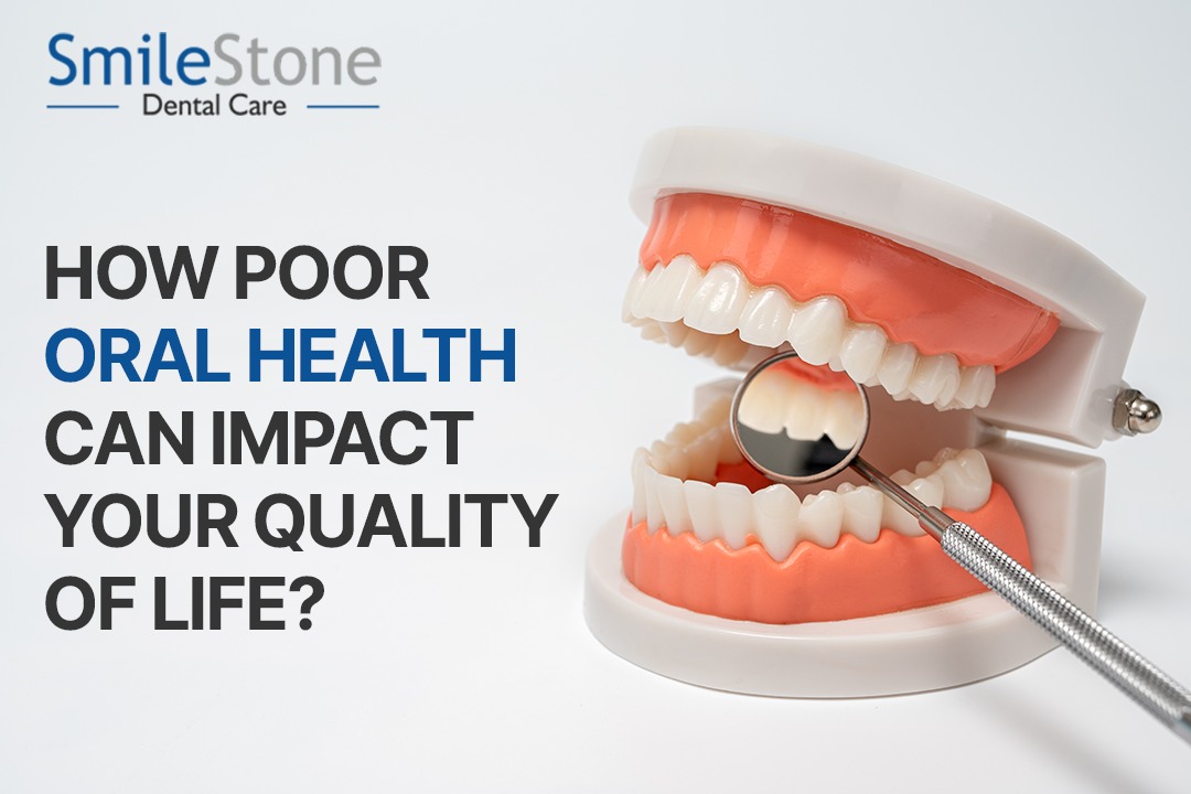 How Poor Oral Health Can Impact Your Quality of Life?