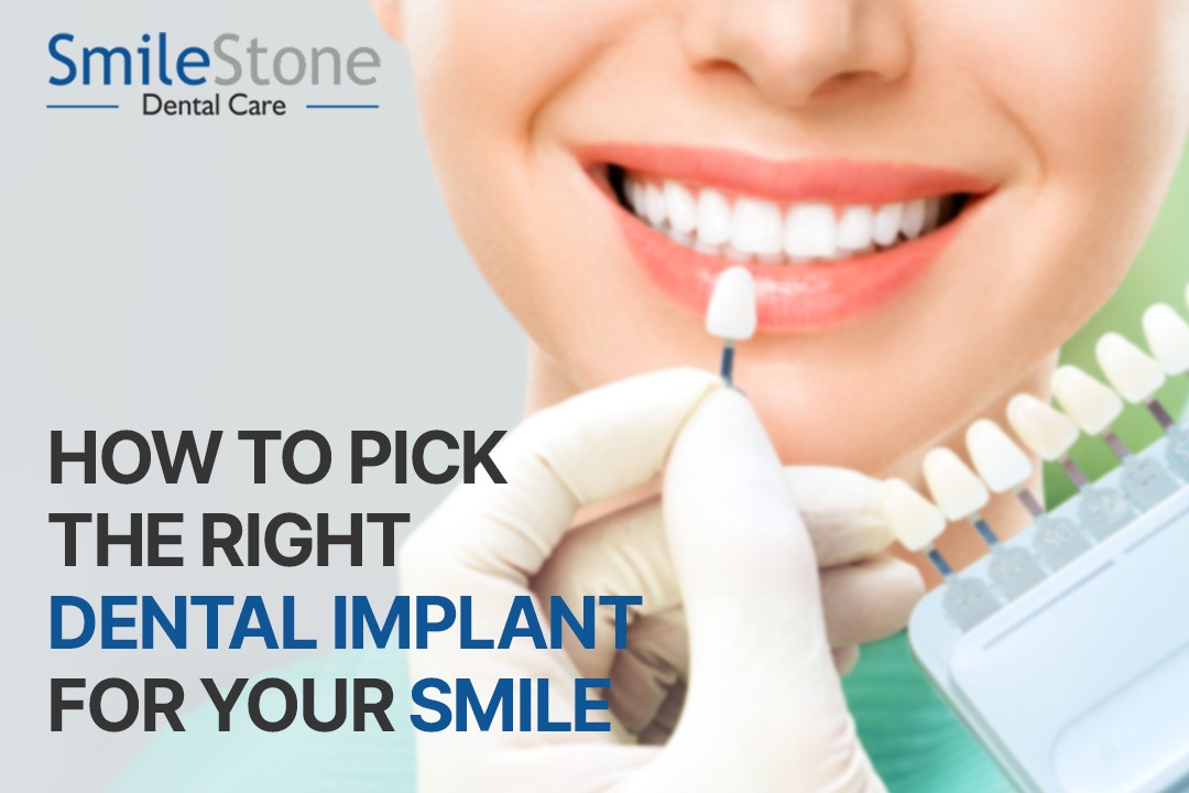 How To Pick The Right Dental Implant For Your Smile