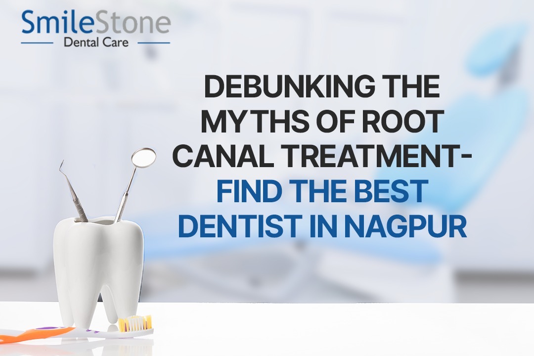 Debunking the Myths of Root Canal Treatment- Find the Best Dentist in Nagpur