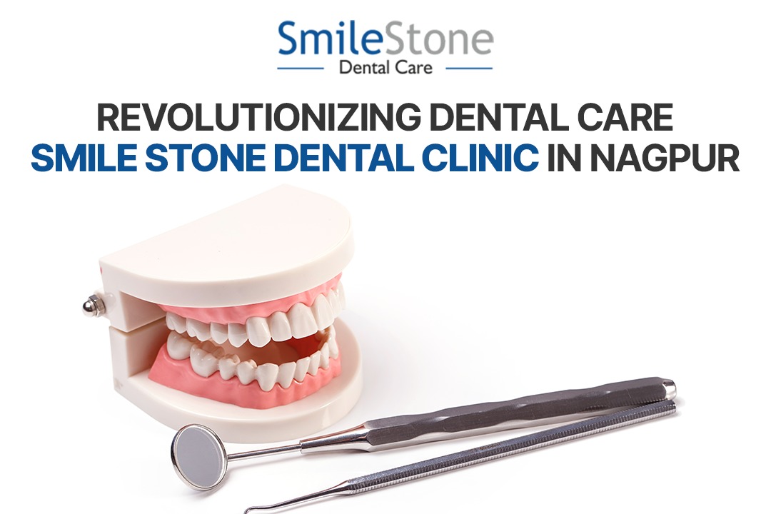 Revolutionizing Dental Care: Smile Stone Dental Clinic in Nagpur