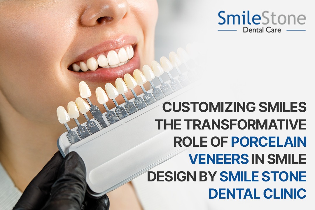 Customizing Smiles the Transformative Role of Porcelain Veneers in Smile Design by Smile stone Dental clinic