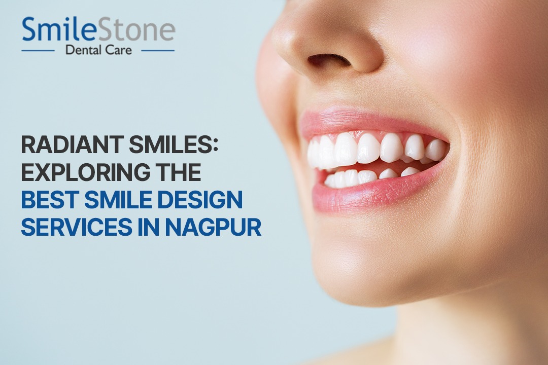 Radiant Smiles: Exploring the Best Smile Design Services in Nagpur