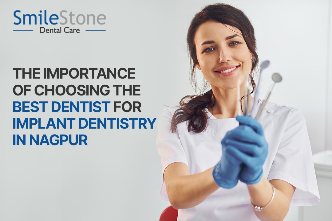 The Importance of Choosing the Best Dentist for Implant Dentistry in Nagpur