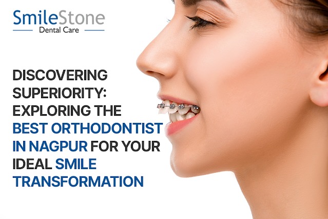 Discovering Superiority: Exploring the Best Orthodontist in Nagpur for Your Ideal Smile Transformation