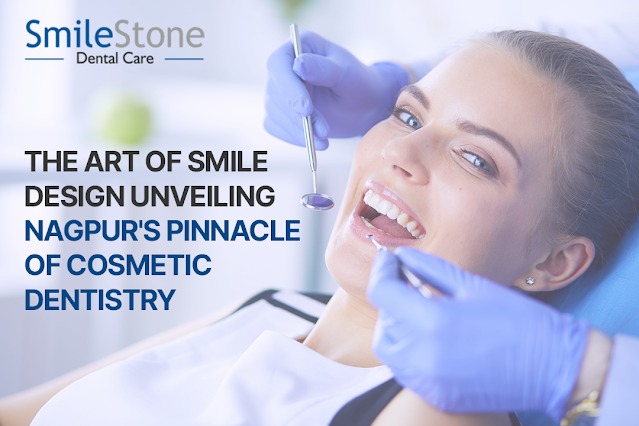 The Art of Smile Design Unveiling Nagpurs Pinnacle of Cosmetic Dentistry