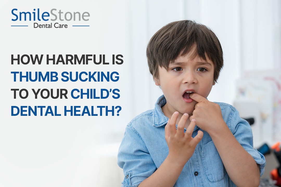 How Harmful is Thumb Sucking to Your Child’s Dental Health?