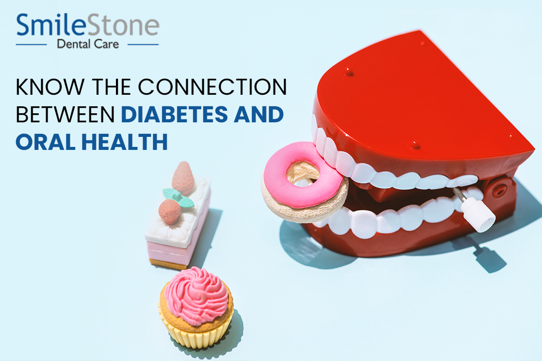 Know the connection between Diabetes and Oral Health