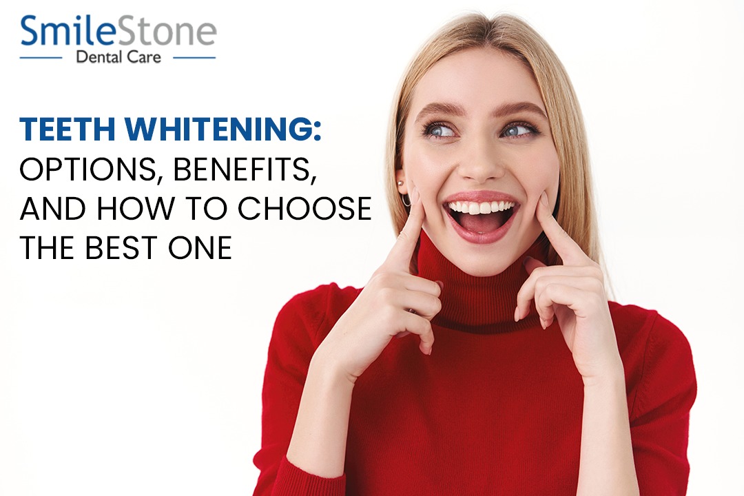 Teeth Whitening: Options, Benefits, and How to Choose the Best One