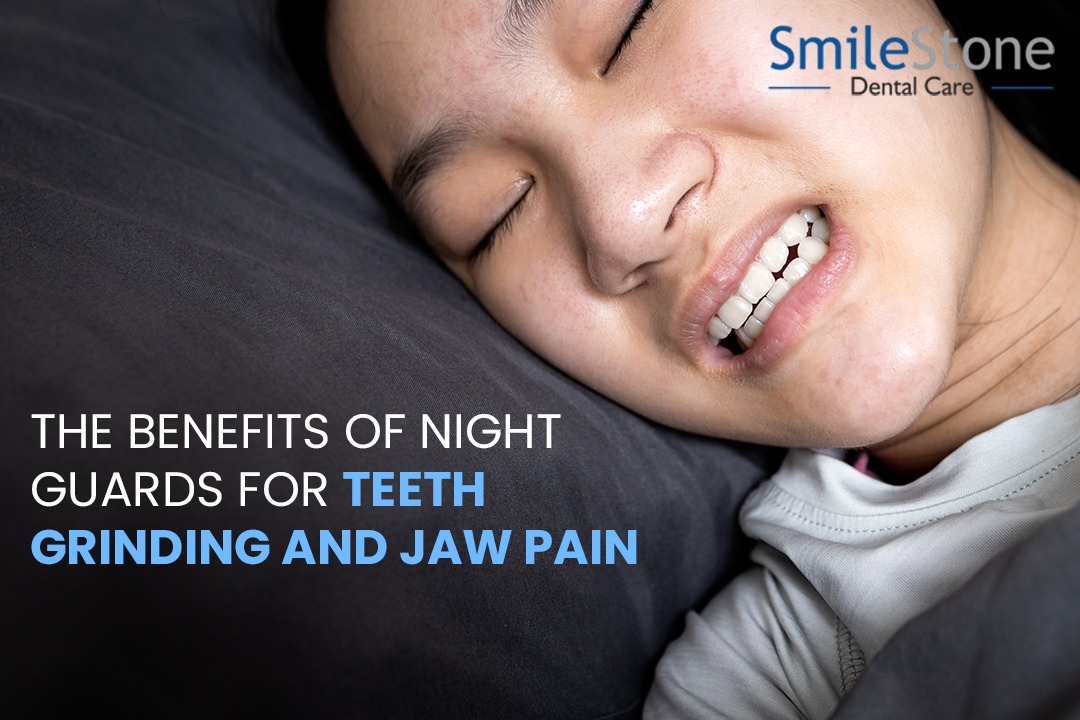 The Benefits of Night Guards for Teeth Grinding and Jaw Pain