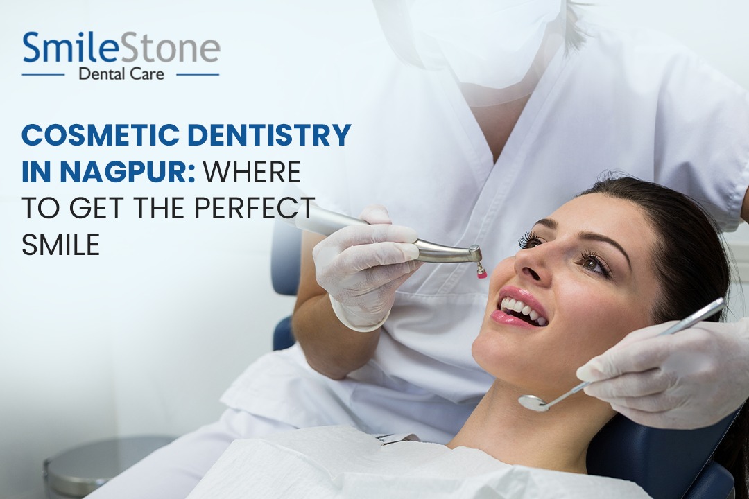 Cosmetic Dentistry in Nagpur: Where to Get the Perfect Smile