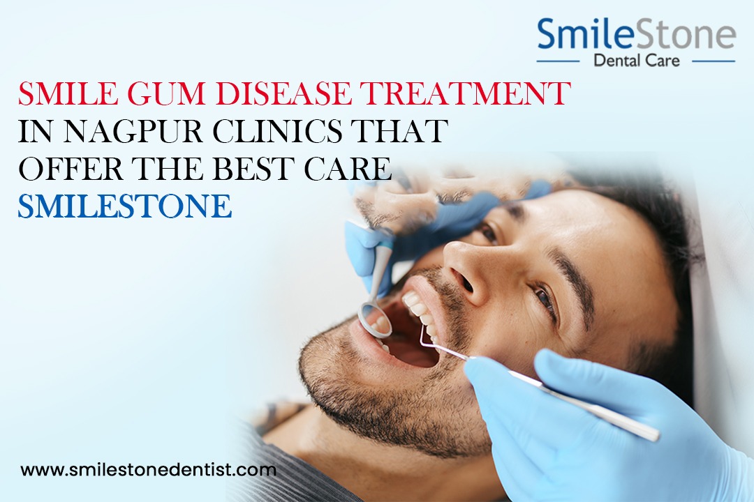 Smile Gum Disease Treatment in Nagpur: Clinics That Offer the Best Care