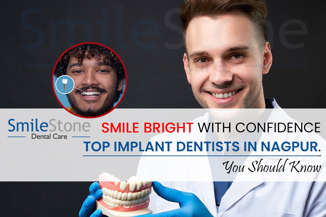 Smile Bright with Confidence: Top Implant Dentists in Nagpur You Should Know