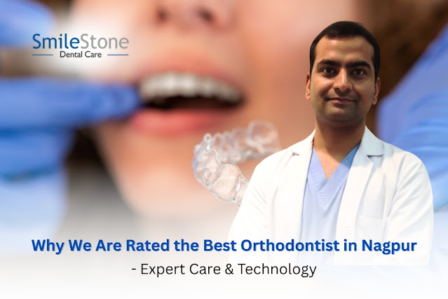 Why We Are Rated the Best Orthodontist in Nagpur: Expert Care & Technology