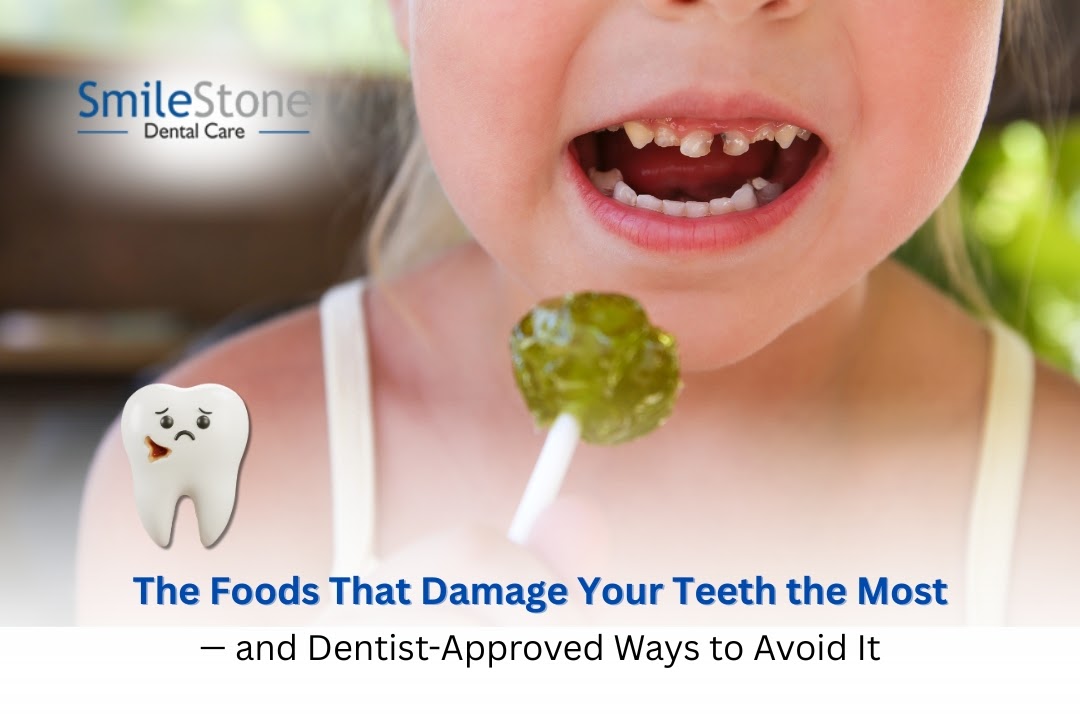 Foods That Harm Your Teeth: Dentist’s Guide to Protecting Your Smile