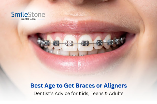 Best Age to Get Braces or Aligners- Dentist’s Advice for Kids, Teens & Adults