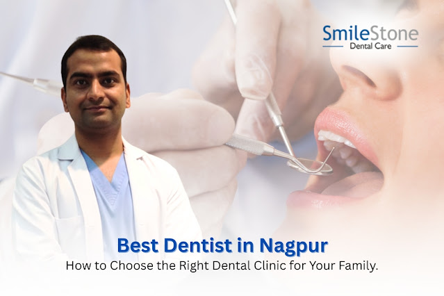 Best Dentist in Nagpur: How to Choose the Right Dental Clinic for Your Family