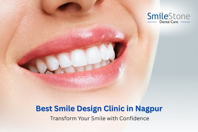 Best Smile Design Clinic in Nagpur – Transform Your Smile with Confidence