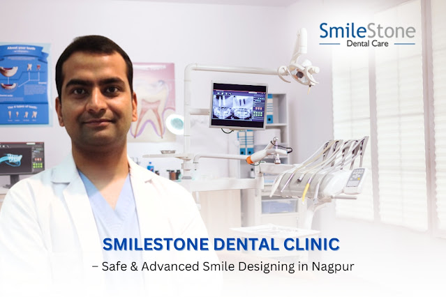 Smilestone Dental Clinic Nagpur – Safe & Advanced Smile Designing in Nagpur
