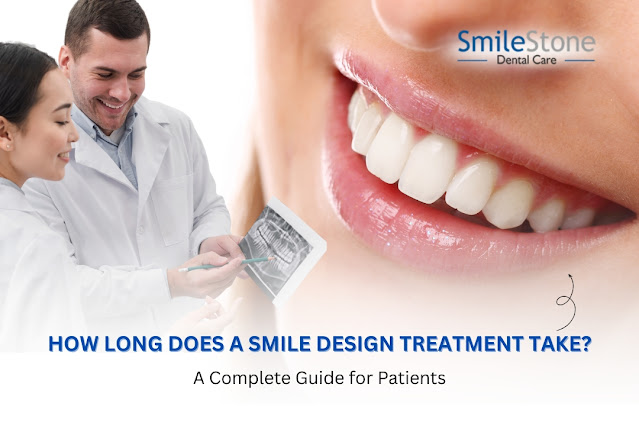How Long Does a Smile Design Treatment Take? A Complete Guide for Patients