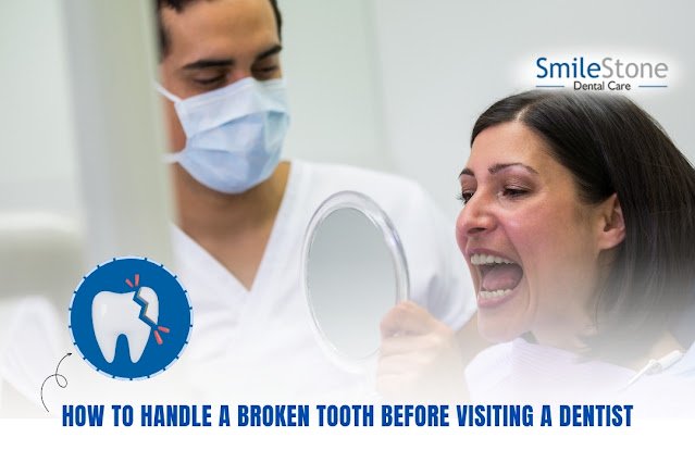 How to Handle a Broken Tooth Before Visiting a Dentist
