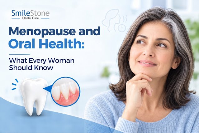 Menopause and Oral Health: What Every Woman Should Know