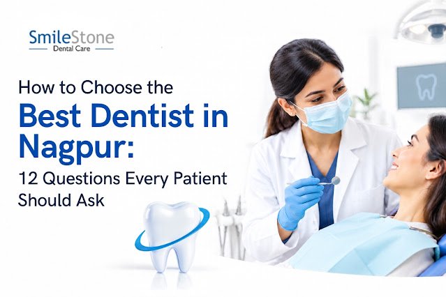 How to Choose the Best Dentist in Nagpur: 12 Questions Every Patient Should Ask